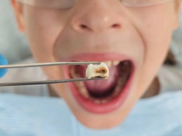 Best Emergency Treatment for Toothache in Hanamaulu, HI
